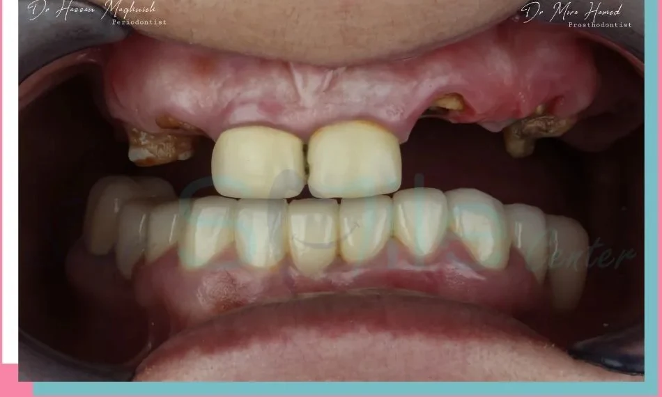 Before dental treatment